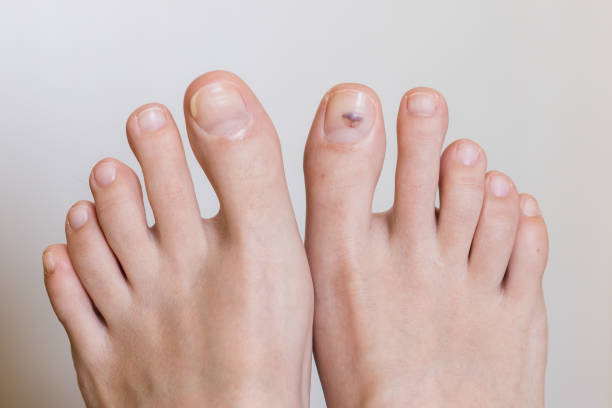 Foot and Nail Care